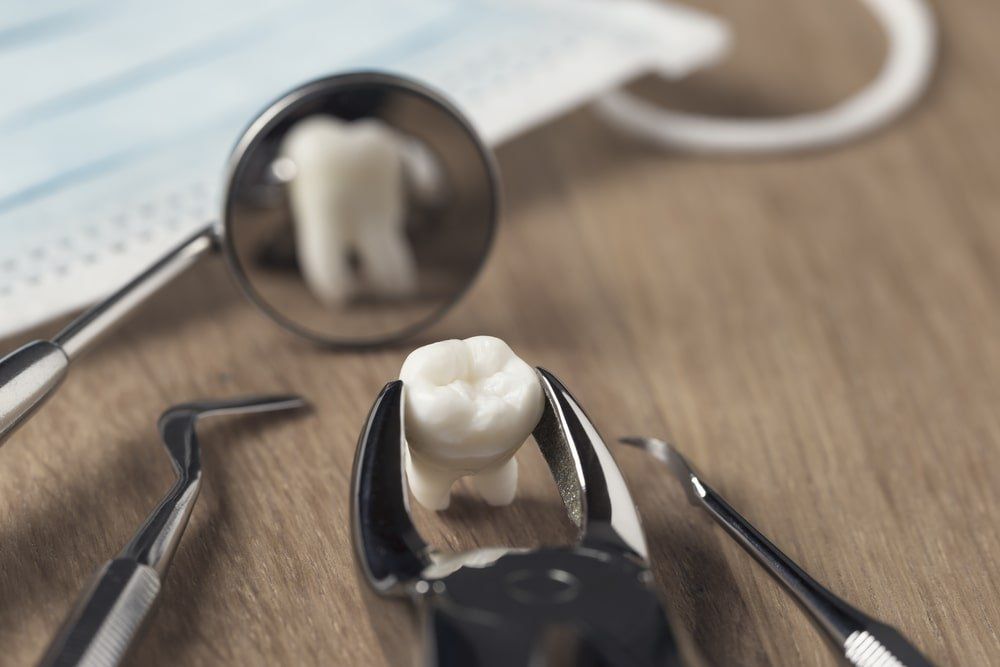Une extraction dentaire chez le dentiste