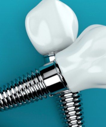 implant