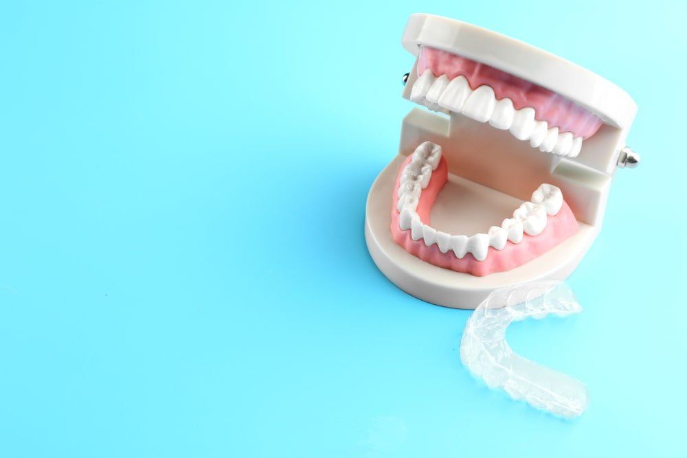 Plaque occlusale à côté d'une dentition de plastique