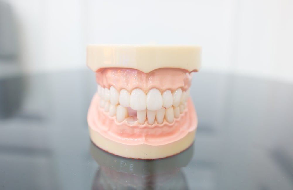 Remplacer des manquantes chez le dentiste